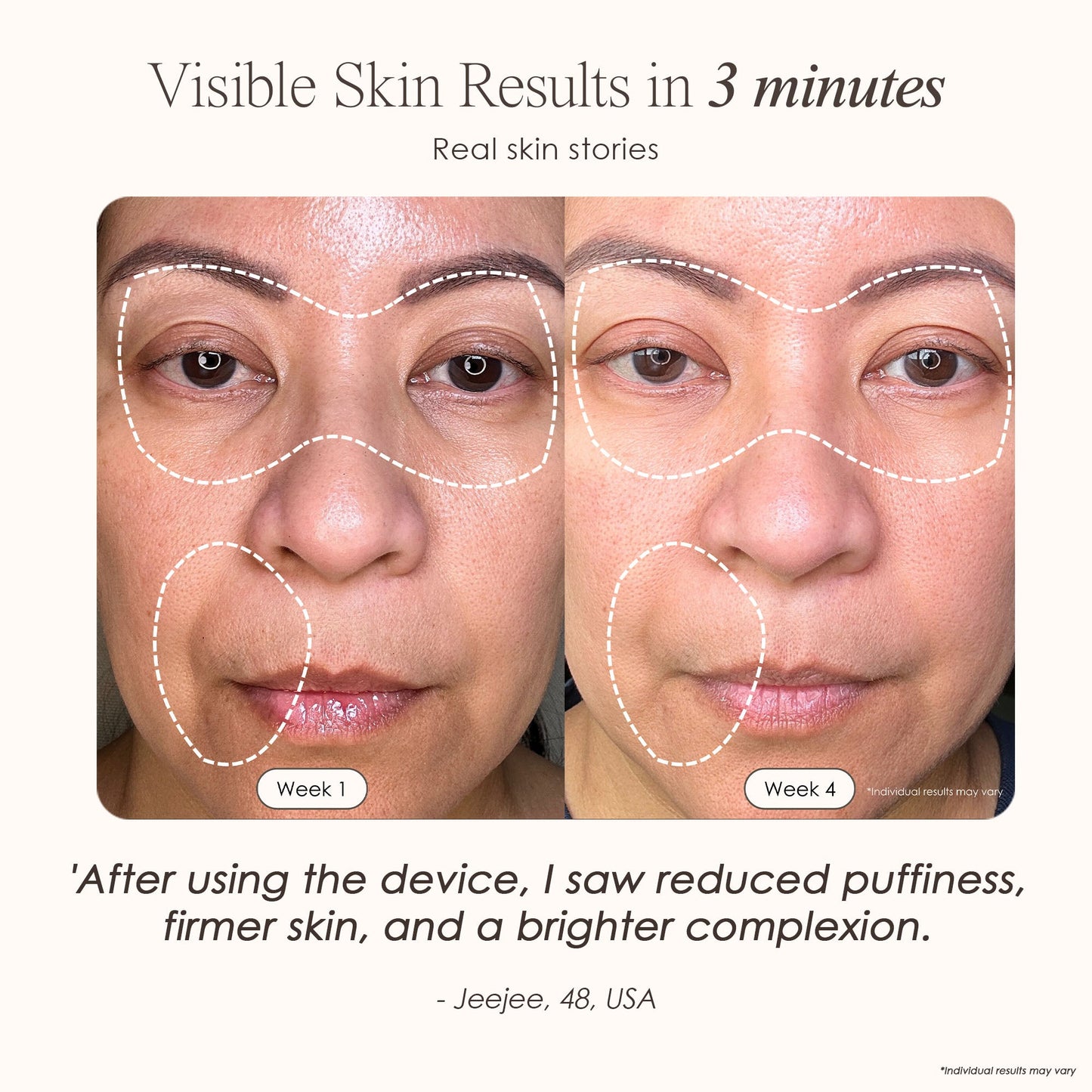 LumaLux Face+ | Pro LED Red Light Therapy Face & Neck Mask