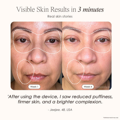 LumaLux Face+ | Pro LED Red Light Therapy Face & Neck Mask