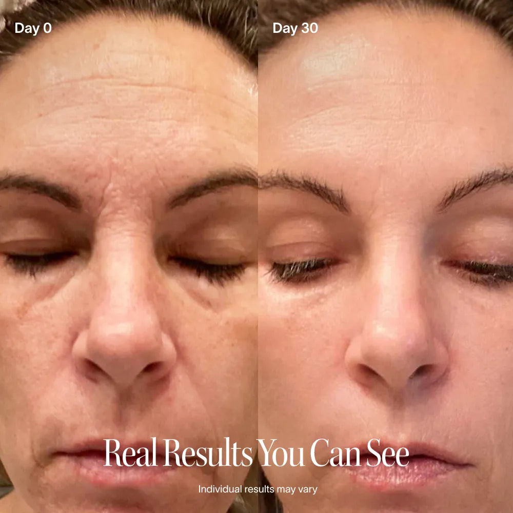 4-in-1 Radiant Renewal® Skincare Wand with Red Light Therapy