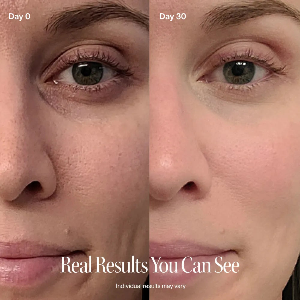 4-in-1 Radiant Renewal® Skincare Wand with Red Light Therapy